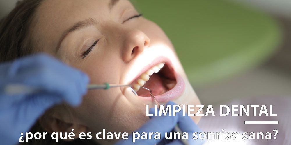 limpieza-dental-en-gijon-bucodent-clinica-dental-2 limpieza dental en Gijón