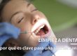 limpieza dental en Gijón