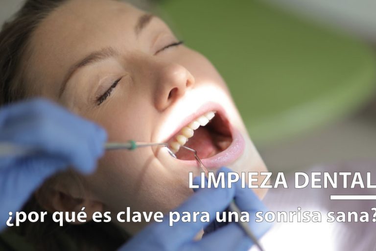 limpieza dental en Gijón